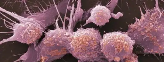 How Cancer Eats Itself To Survive Our Therapies