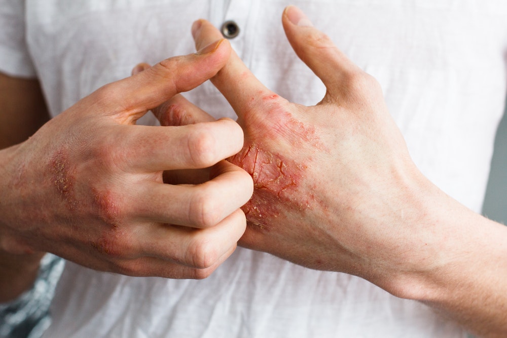 What you need to know about the role your skin plays