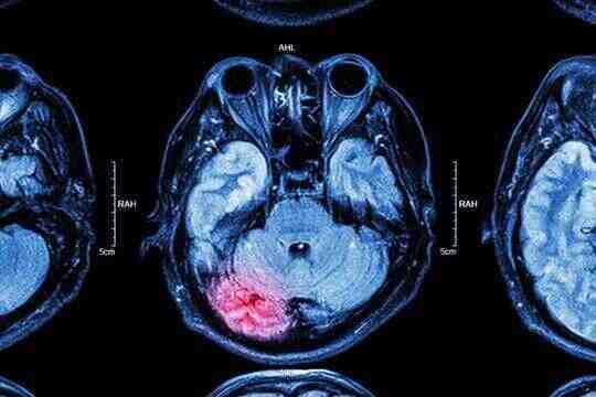 How Injuries Change Our Brain And How We Can Help It Recover