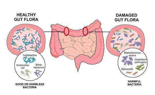 5 Things You Can Do To Make Your Microbiome Healthier